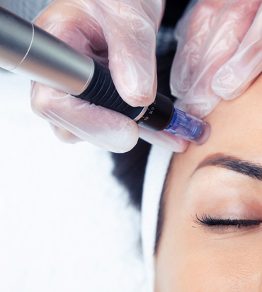 Dermapen Cilt Yenileme